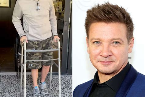 did jeremy renner lose his leg|Jeremy Renner Accident: Actors Recovery After Snowplow。